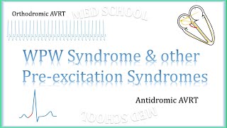 WPW Syndrome amp other preexcitation syndromes [upl. by Eussoj]