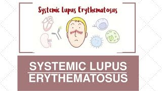 Lupus erythematosus Ways to adapt to this immune disease [upl. by Formenti]