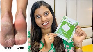 Viral exfoliating foot mask indianmomkanchan7509 [upl. by Latona437]