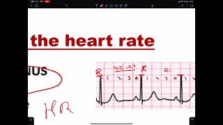 CVS PHYSIOLOGY Arrhythmia [upl. by Atahs]