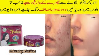 Faiza Beauty Cream Review Usage Benefits Side Effect Skin Whitening Acne Removal Night Cream [upl. by Attener]