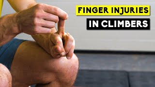 Finger Injuries in Climbers  Lattice Training X Sheffield Climbing Clinic  Part 2 [upl. by Mikiso]