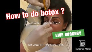 MA TECHNIQUE POUR BIEN FAIRE DES INJECTIONS DE BOTOX AU VISAGE HOW DO DO BOTOX INJECTIONS [upl. by Vanderhoek]