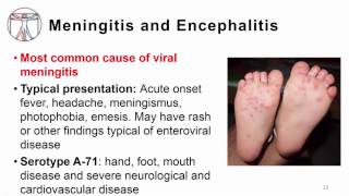 5 Enterovirus clinical manifestations including poliore [upl. by Heall394]