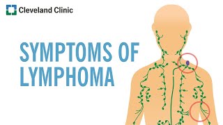 Warning Signs of Lymphoma [upl. by Aikemat]