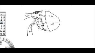 Hydrostatic pressure CHF [upl. by Aioj561]