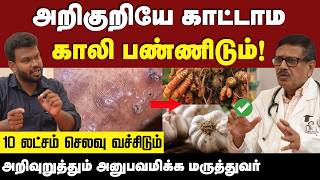 Fatty Liver  கல்லீரல் பற்றி யாருக்கும் தெரியாத அதிர்ச்சி தகவல்ககள் 😱  Liver  Positivitea [upl. by Scully229]