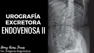 Urografía Excretora II [upl. by Sander]