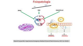 Fisiolopatología de la Hipertensión Arterial [upl. by Oniotna]