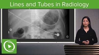 Lines and Tubes in Radiology – Radiology  Lecturio [upl. by Maritsa903]