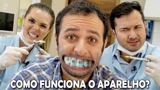 Como o aparelho desentorta os dentes Boravê [upl. by Ariik827]