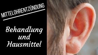 Mittelohrentzündung  Urasche Behandlung und Hausmittel [upl. by Vernon]