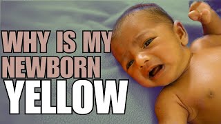 Newborn Jaundice Causes Symptoms and Treatment [upl. by Phillip]