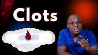 Understanding Menstrual Clots Causes amp Remedies  When to Worry [upl. by Ailecec728]