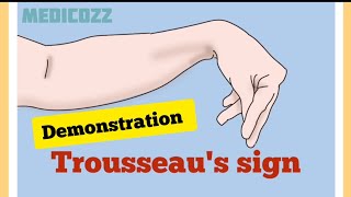 Trousseaus sign in Hypocalcemia  Patient video  causes treatment prevention [upl. by Cull420]