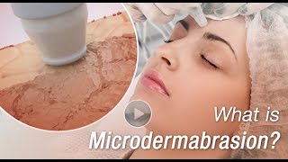 What is Microdermabrasion 3D Animation Video Explains [upl. by Dorcas]