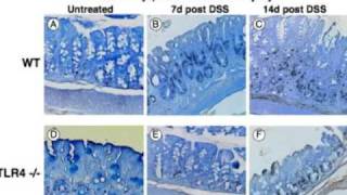 Tolllike receptor signaling in the intestine friend or foe Part 2 [upl. by Ardnuasak]