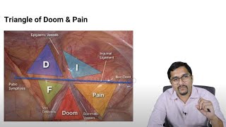 Marrow E6 Revision Videos Surgery Sample Video [upl. by Satsoc578]