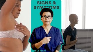 What are the Signs and Symptoms of Breast Cancer With Dr Tasha [upl. by Lyndsie]