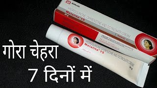 गोरा चेहरा सिर्फ 7 दिनों में Melalite 15 Cream Review Hindi [upl. by Skell]