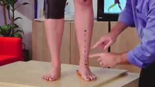 Learn about Pronation and how to Prevent Pronation [upl. by Symons]