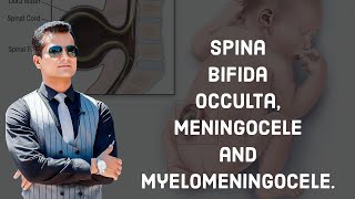 Spina Bifida occulta Meningocele and myelomeningocele [upl. by Sikorski873]