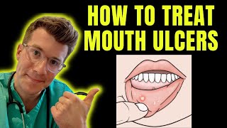 How to recognise and treat Mouth Ulcers getting rid of canker sores  Doctor ODonovan explains [upl. by Bourque]