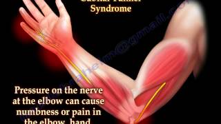 Cubital Tunnel Syndrome Ulnar Nerve Entrapment  Everything You Need To Know  Dr Nabil Ebraheim [upl. by Otte]