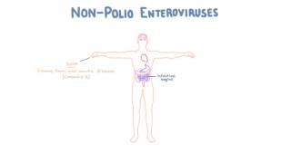 Non Polio Enteroviruses  Echovirus Coxsackievirus and Enterovirus [upl. by Aianat]