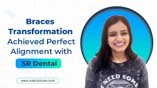 Braces Transformation Achieved Perfect Alignment with SR Dental😄😁 [upl. by Sill]