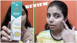 NOMARKS Ayurvedic Antimarks Cream Review  For Oily Skin  Good Product [upl. by Xerxes]