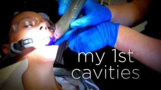 MY FIRST CAVITIES [upl. by Domini]