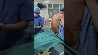 Spinal Anaesthesia for Low Cardiac Reserve patient low EFanesthesia spinal [upl. by Audra659]