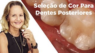 InspirandoDentistas23  Cores para posteriores [upl. by Hsemar]