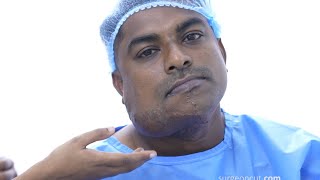 Large Hemangioma Removal Procedure for Young Man  Dr Sunil Richardson [upl. by Luebke]