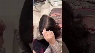 How TO Cover Up Hair Thinning Without Using Extensions  Hair Thinning Solutions For Women shorts [upl. by Elnore]