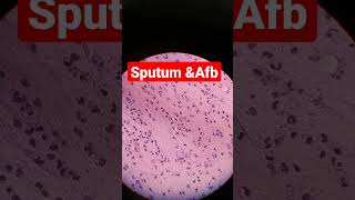 sputum for AFB Test  Afb stain  zn stain viral youtubeshorts sorts dmlt [upl. by Jack]