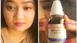 Berberis Aquifolium Q for Skin Whitening  Effective or Not  My Real Clinical Experience [upl. by Melise]