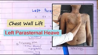 Clinical Sign Of Right Ventricular Hypertrophy  Left Parasternal Heave How To Palpate [upl. by Drona]