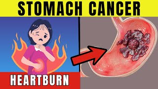 8 Warning SIGNS of STOMACH CANCER  Healthy Vibrance [upl. by Ahseihs]