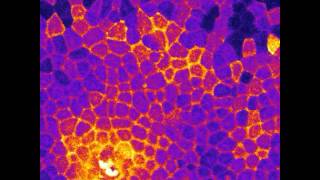 Calcium signalling [upl. by Mord]