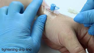 How to start IV drip Step by step tutorial from nurse [upl. by Tupler]