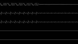 Jeroen Tel  quotAtmospherequot YM2612  OKI MSM5232 Oscilloscope View [upl. by Nicolas]