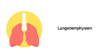 Lungenemphysem  Erkrankungen der Atemwege [upl. by Alameda]