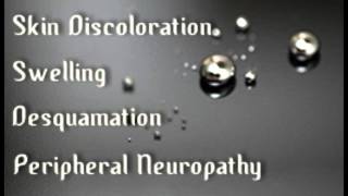 Mercury Poisoning Symptoms [upl. by Adidnac]