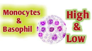 Monocytes High  Basophil High [upl. by Suoirrad]