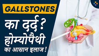 क्या होम्योपैथी से पित्ताशय gall bladder की पथरी ठीक हो सकती है  Homeopathy vs Surgery [upl. by Zurn]