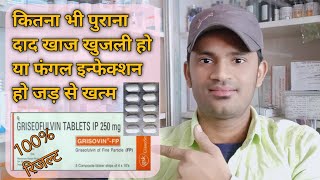 Grisovin fp 250 tablet use dose benefits side effects full review in hindi पुरी जानकारी हिन्दी में [upl. by Neerihs]