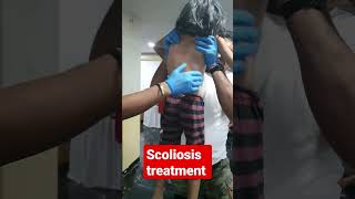 scoliosis treatment 93085113578409313131 [upl. by Melliw870]