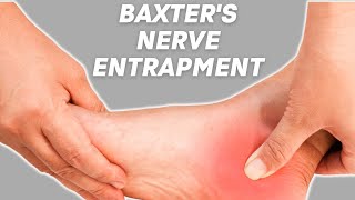 Baxters Nerve Entrapment COMPLETE OVERVIEW by Physical Therapists [upl. by Hoenack869]